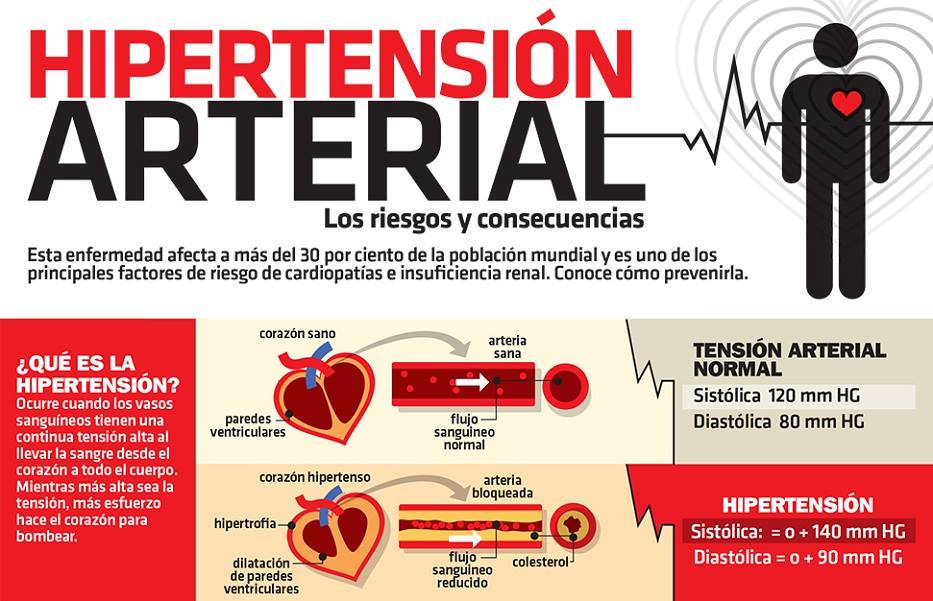 Hipertension riesgos y consecuencias