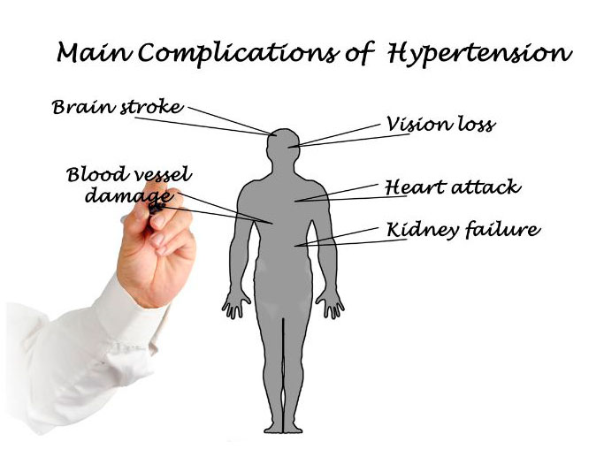 hipertension arterial comlicaciones