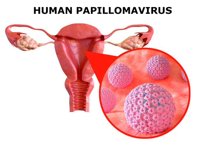 virus papiloma vhp
