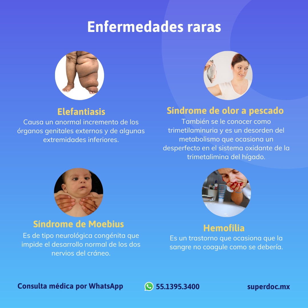 ¿Qué Y Cuáles Son Las Enfermedades Raras Que Existen?