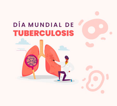 tuberculosisi dia