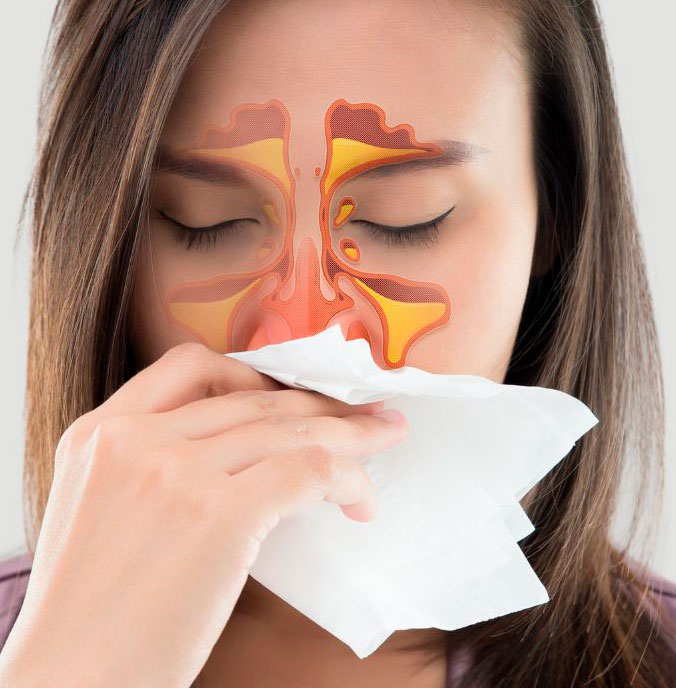 enfermedades sangrado nasal