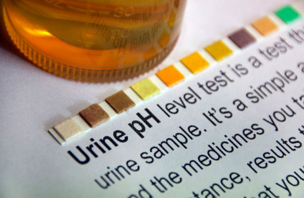 Urine Ph