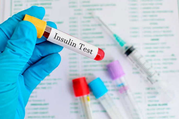 insulin test